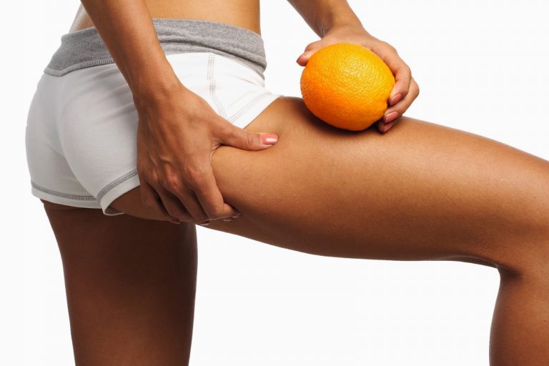 Eliminar la celulitis
