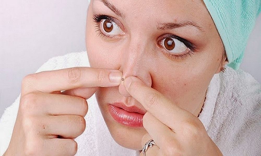 los puntos negros, facial