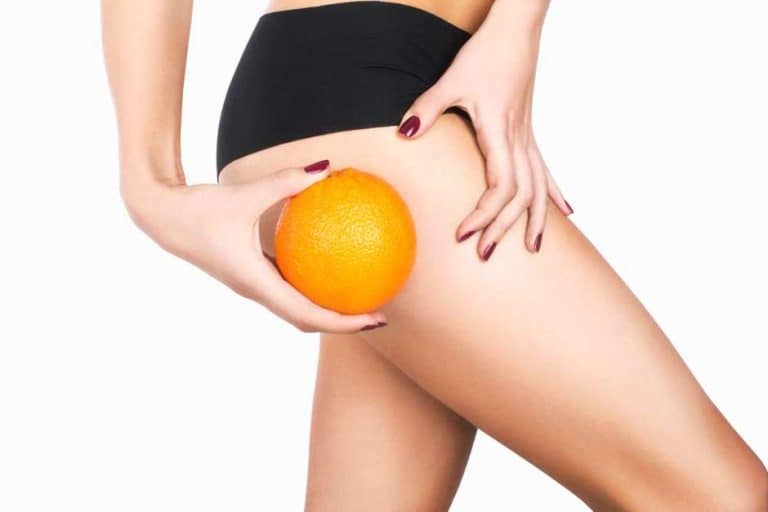 Para combatir la piel de naranja nada mejor que la mesoterapia