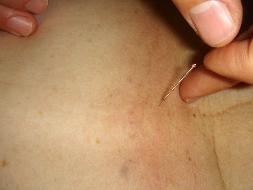 terapia neural holistica