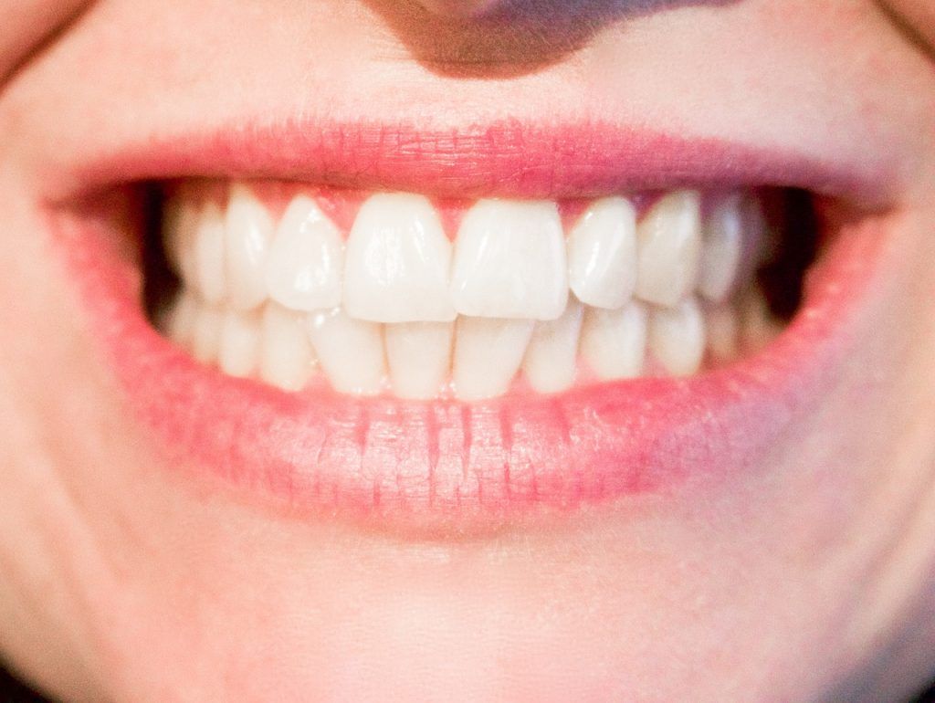 sonrisa perfecta