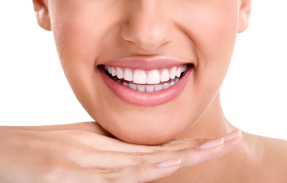 la sonrisa perfecta