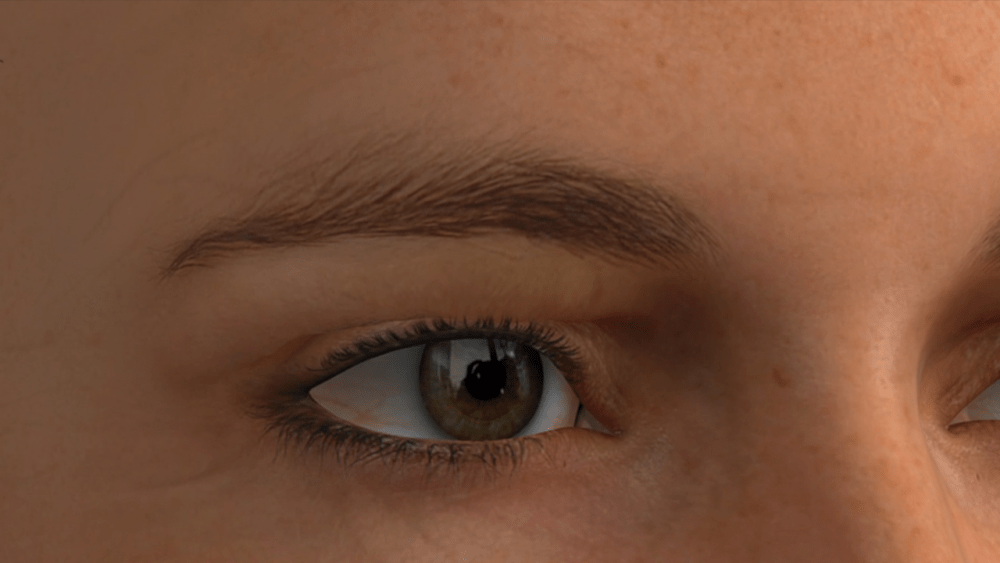 Complicaciones de la blefaroplastia