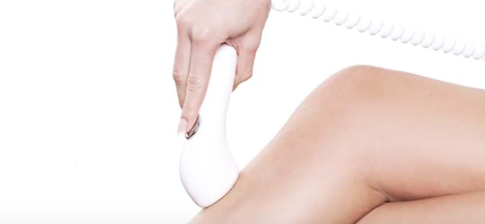 depilación laser sin dolor