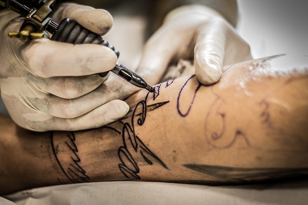 Todos los tatuajes se pueden eliminar