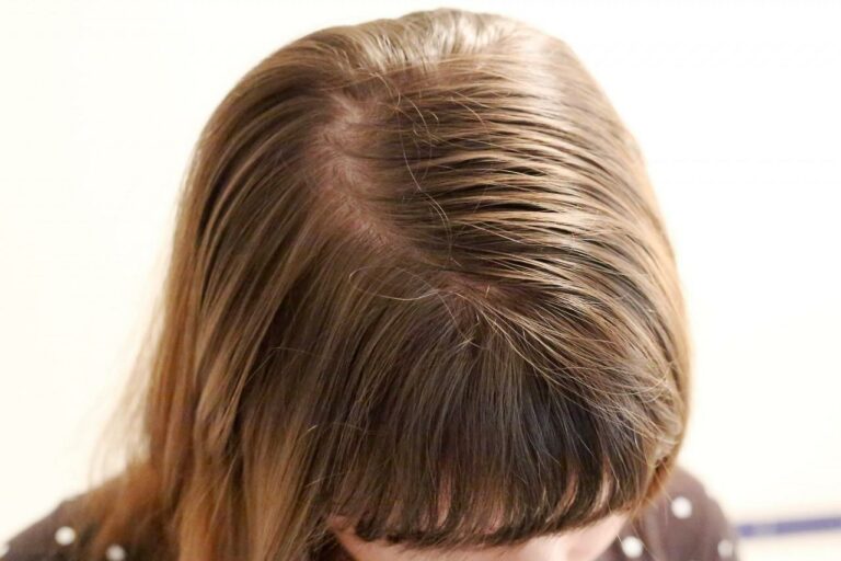 controlar el cabello graso