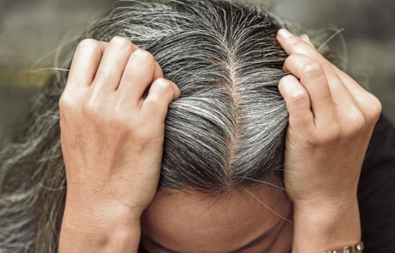 el estrés produce canas
