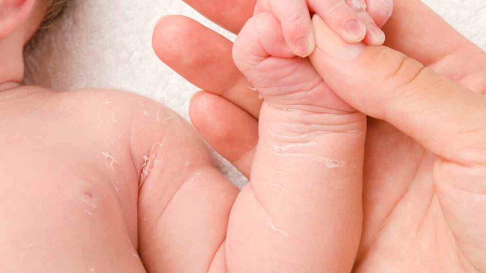 Cuidados para la piel de bebé