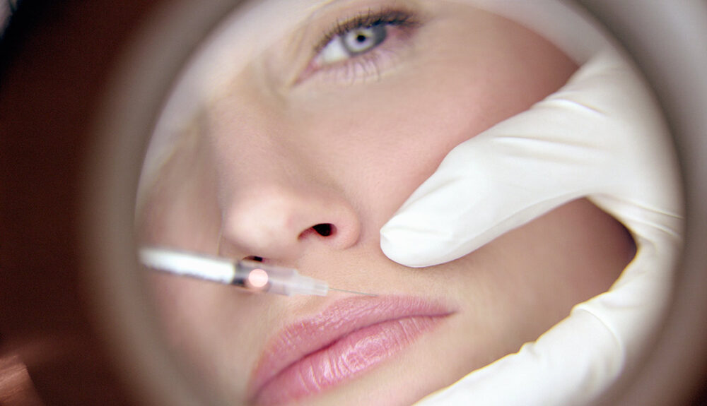 inyección de bótox para eliminar arrugas faciales