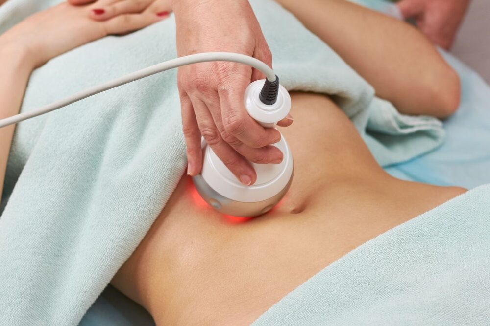 La radiofrecuencia puede ayudarte a reducir la grasa localizada