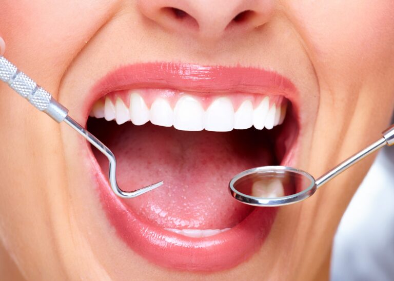 tratamientos de estética dental más solicitados
