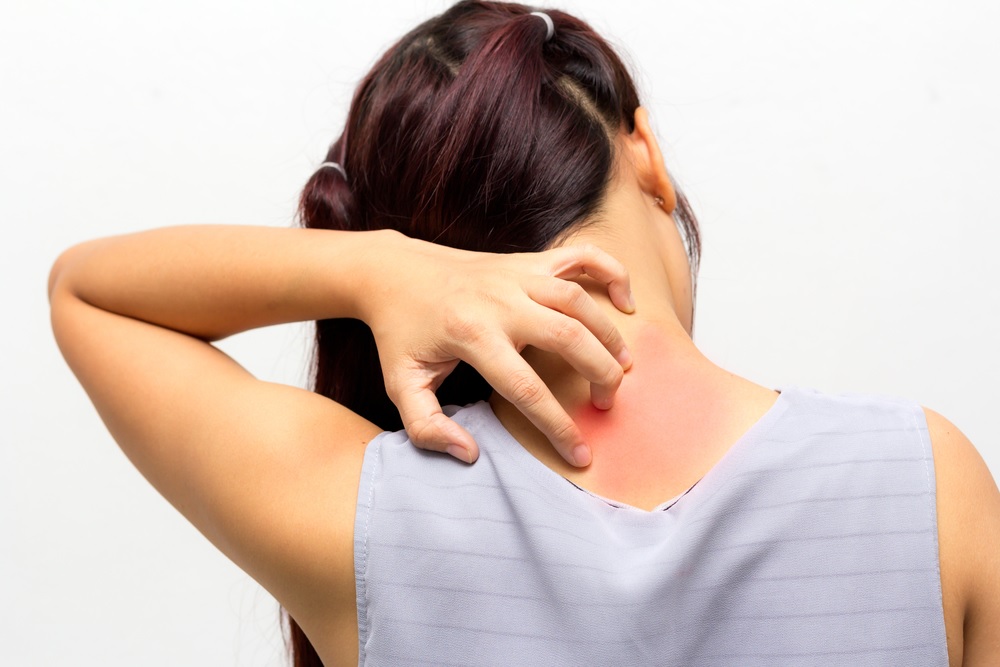 La temperatura y el uso de productos muy fuertes para la piel pueden agravar los síntomas de la dermatitis atópica