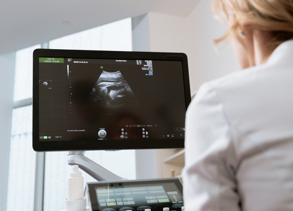 Para ser madre soltera la opción más viable es someterte a un tratamiento de fertilidad