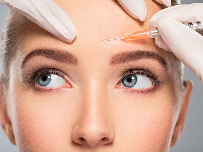 efectos del Botox