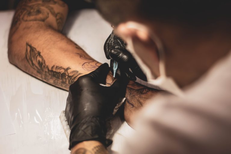 Eliminar tatuajes