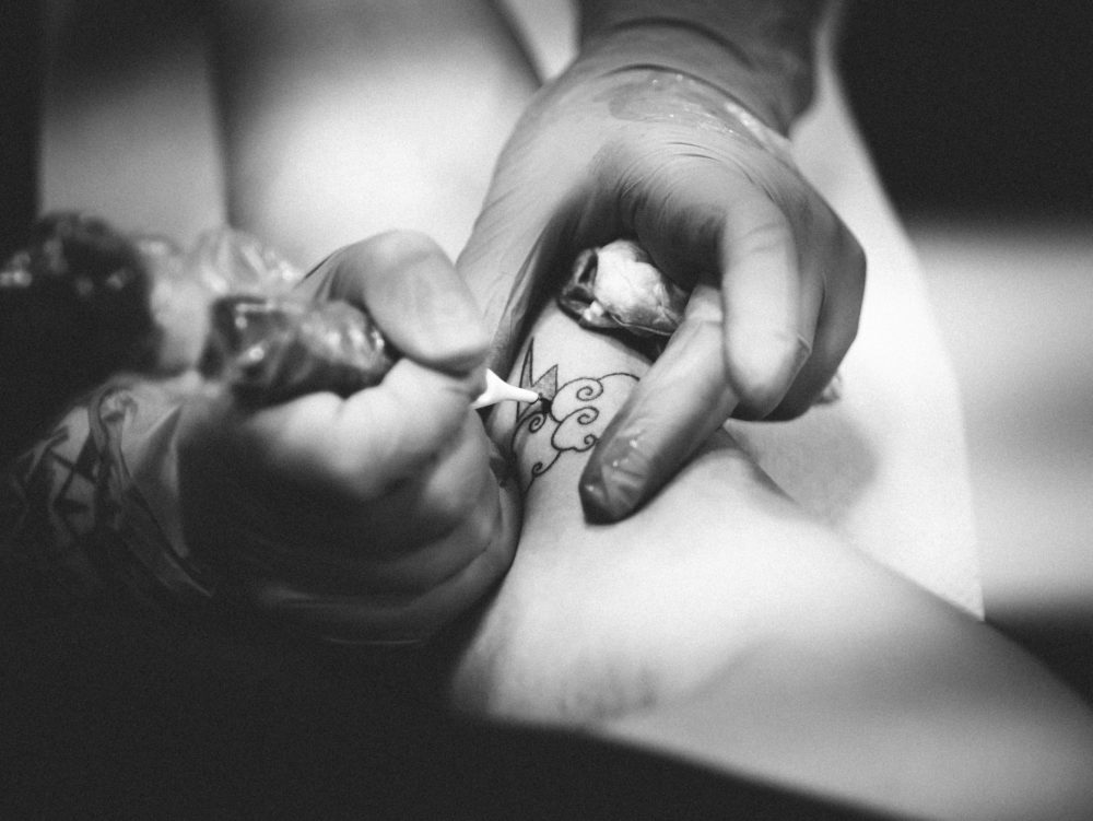 Eliminar tatuajes