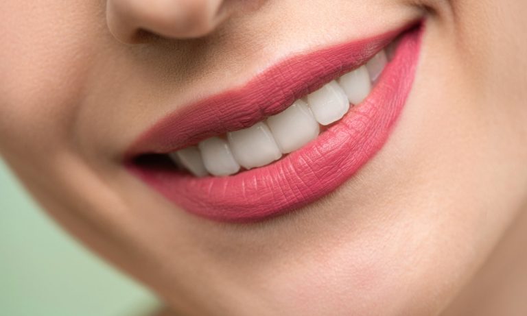 Sonrisa perfecta